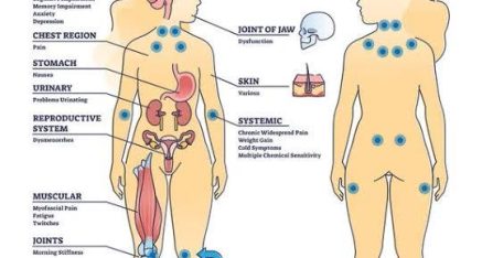 La Fibromialgia mejora cuando vas al psicólogo