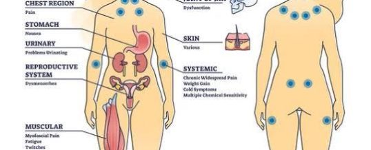 La Fibromialgia mejora cuando vas al psicólogo